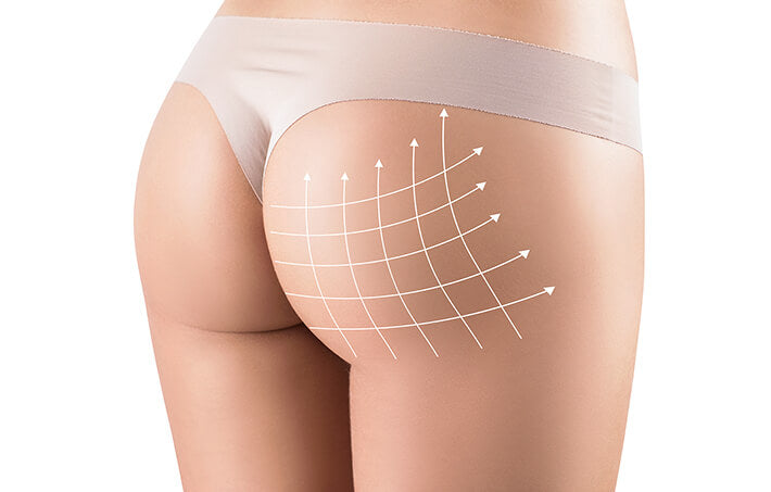 Non-Surgical ButtLift