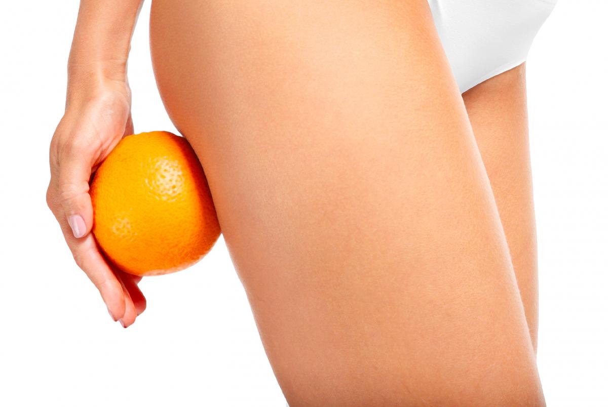 Anti-Cellulite Treatment