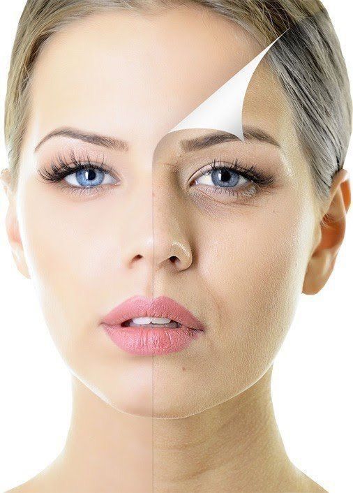 Age Reverse Hyaluronic Acid Treatment